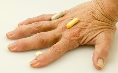 rheumatoid arthritis gyulladása)